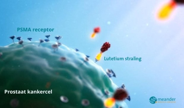 Tekening van prostaat  kankercel met Lutetium bestraling